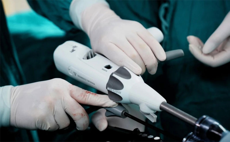 from-manual-to-powered-redefining-surgical-stapling7.jpg